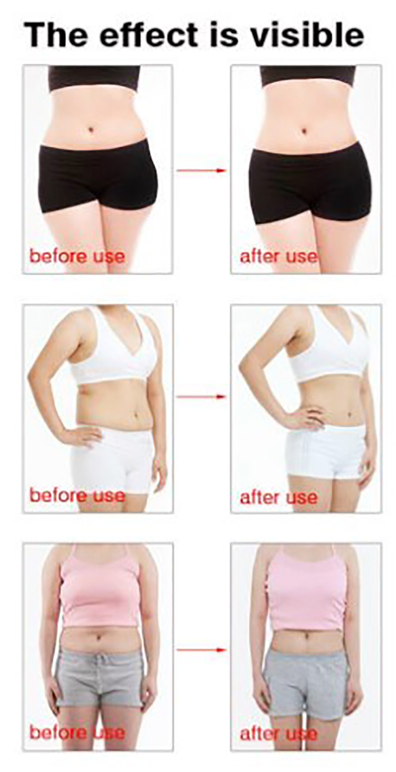 Cavitation+ RF Body Slimming System6